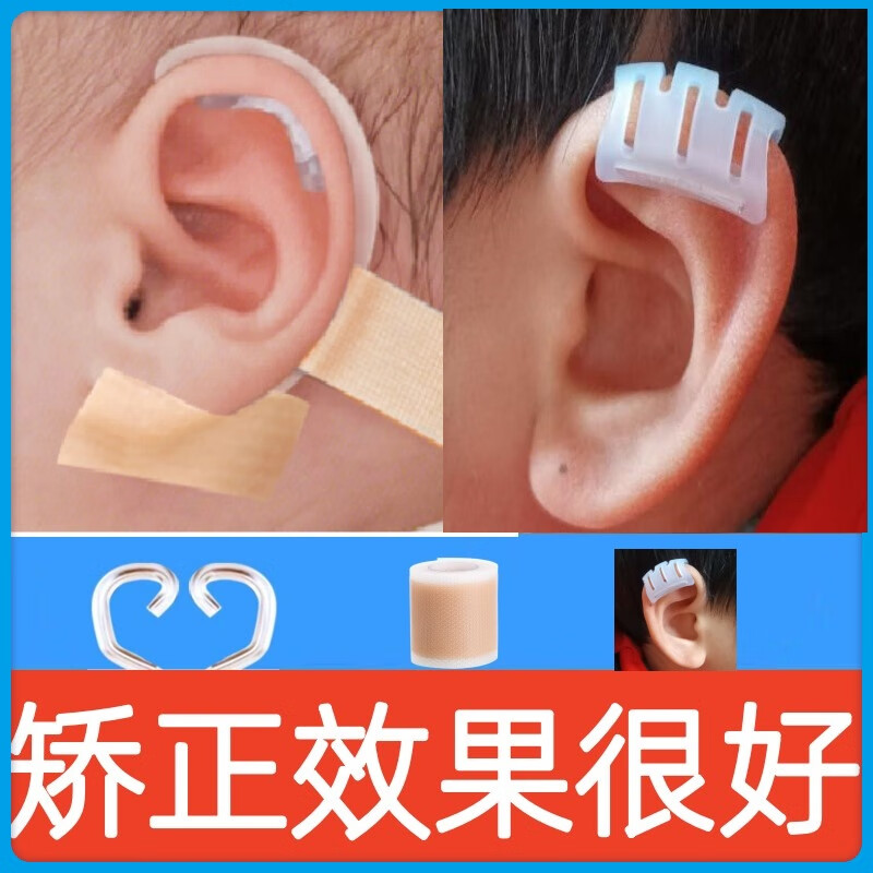 熊来跑耳朵矫正器婴儿新生儿贴头耳招风耳环缩耳定型硅胶耳廓贴纠正耳