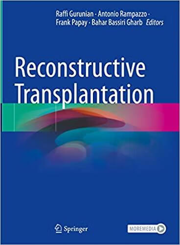 预订 reconstructive transplantation