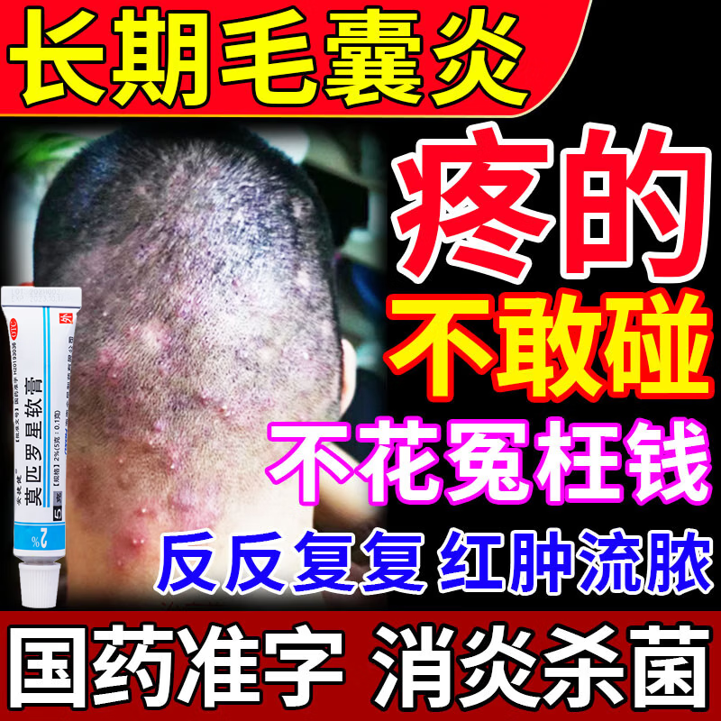 长疙瘩脓包脂溢性皮炎痤疮前胸后背毛囊发炎头皮瘙痒 莫匹罗星软膏 1