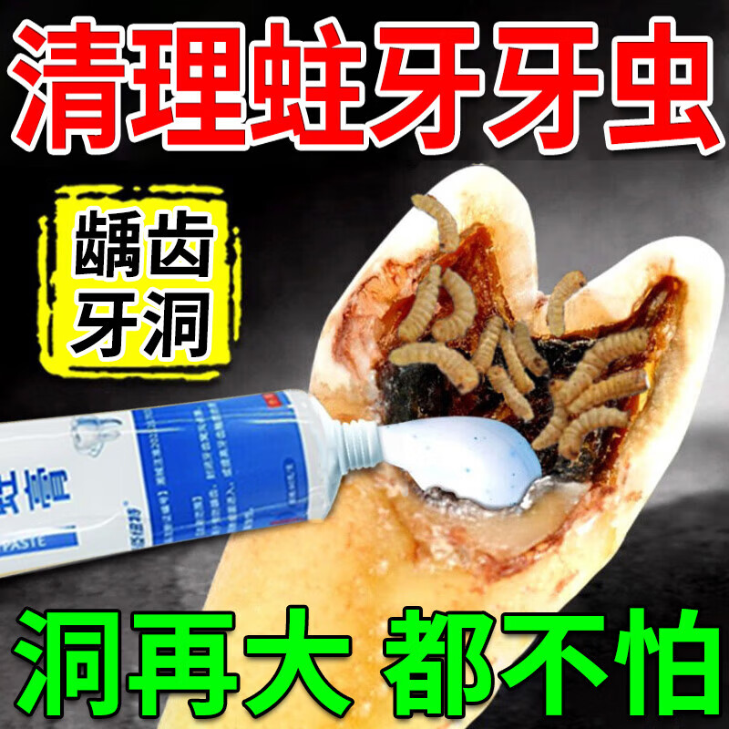 修正修正防蛀牙膏蛀牙洞修复龋齿儿童蛀牙痛虫牙蛀牙烂牙膏