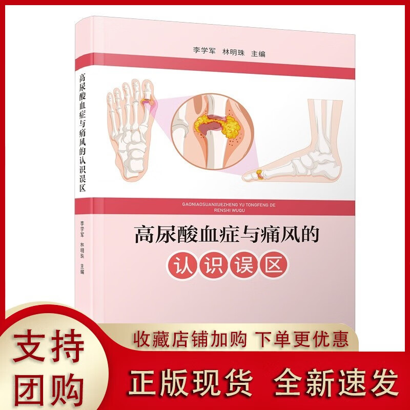 高尿酸血症与痛风的认识误区