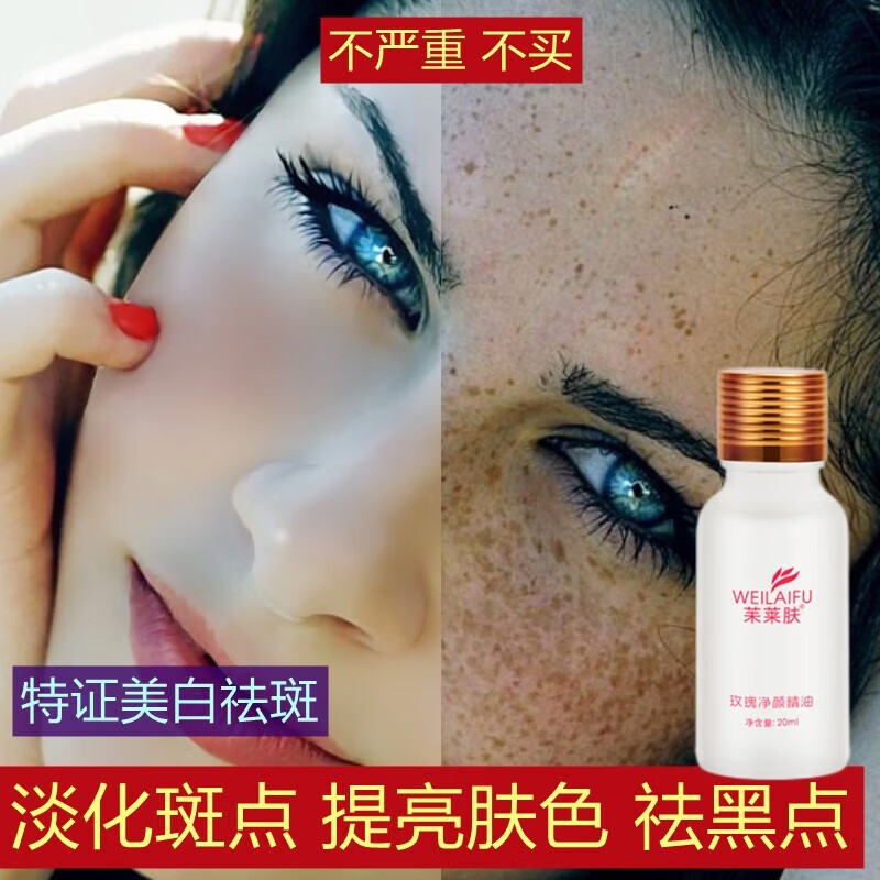NHFOUYOU祛斑精华油点黑点玫瑰净颜精油补水美白提亮肤色溶斑精华美白淡斑 1瓶【体验装】