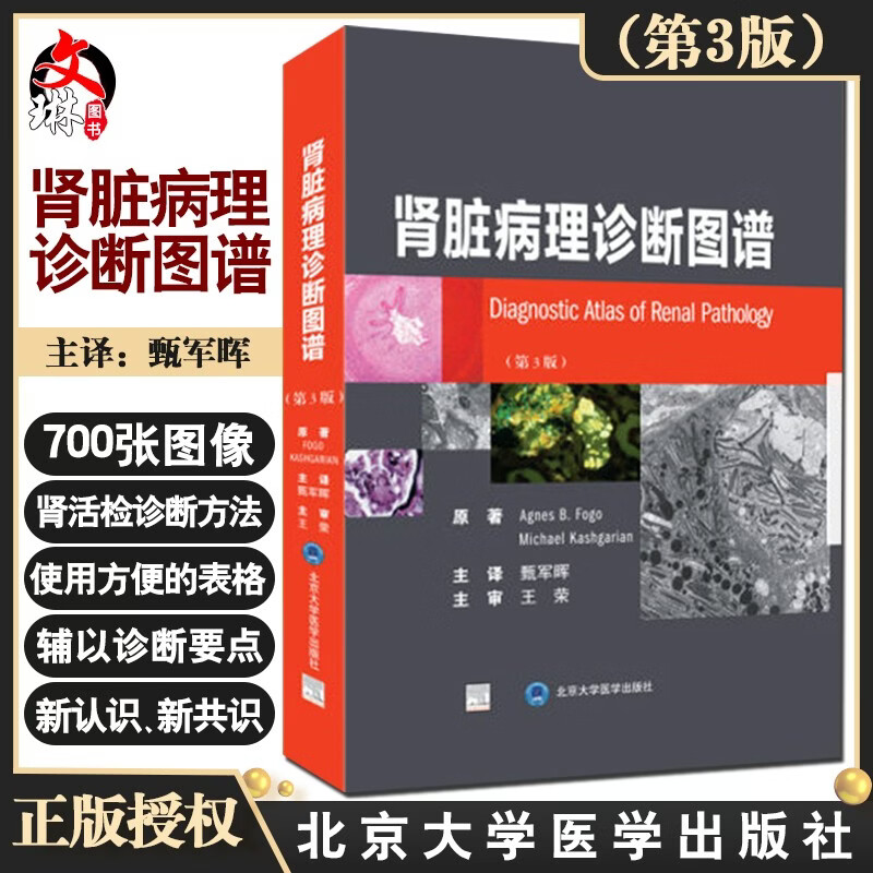 肾脏病理诊断图谱(第3版)用于诊断肾脏疾病的实用参考书 原发性肾小球