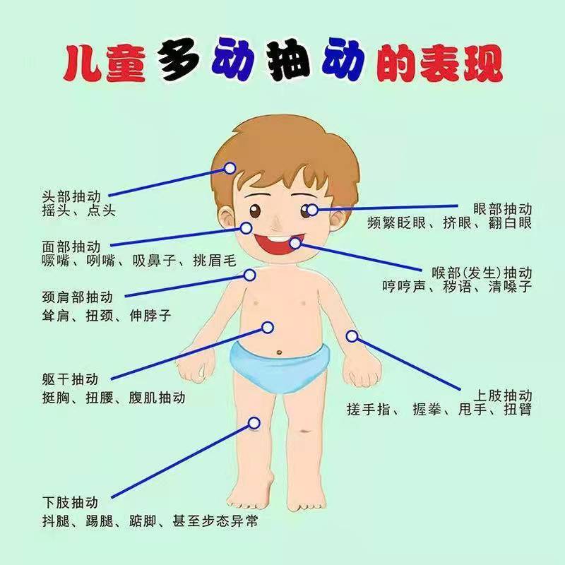 安诺宁儿童多动贴抽动症儿童贴多动症贴清嗓子眨眼频繁肚脐贴少儿多动