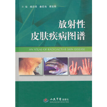 放射性皮肤疾病图谱
