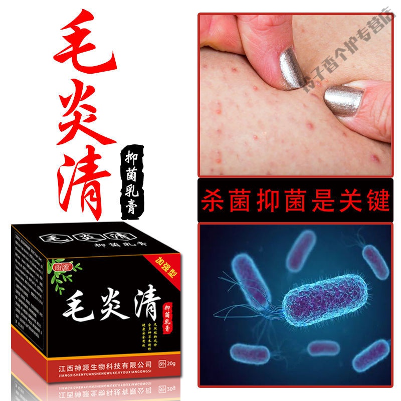 头皮毛囊l炎胸前后背痘痘头部疙瘩脸部痤l疮脓疮包皮囊l炎止痒膏脸部