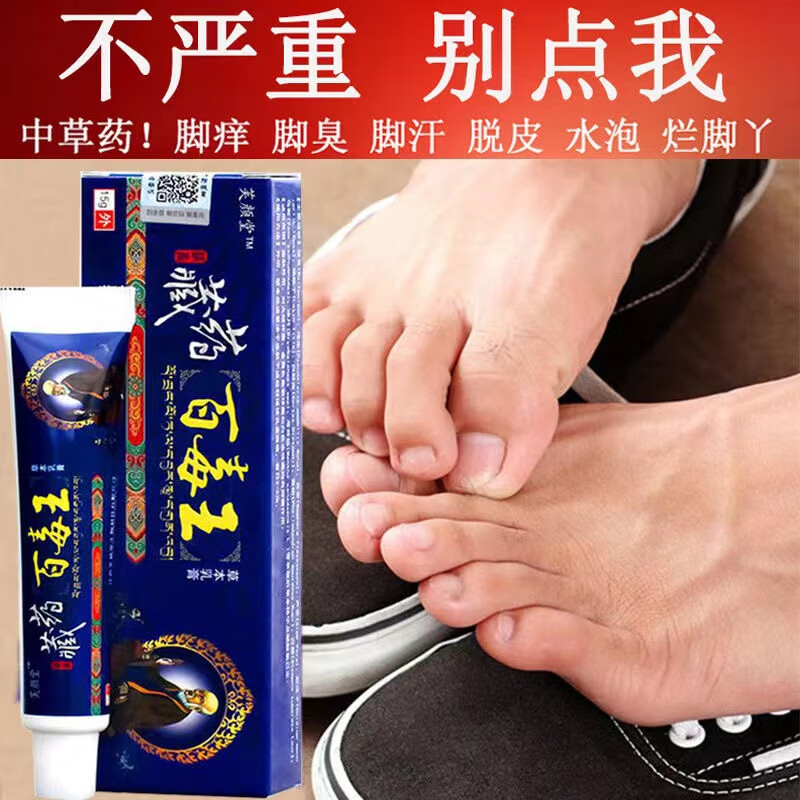 凤武堂百毒王脚气膏去真菌脚臭喷雾脚痒烂l脚丫止养脱皮皮l炎湿l疹 单