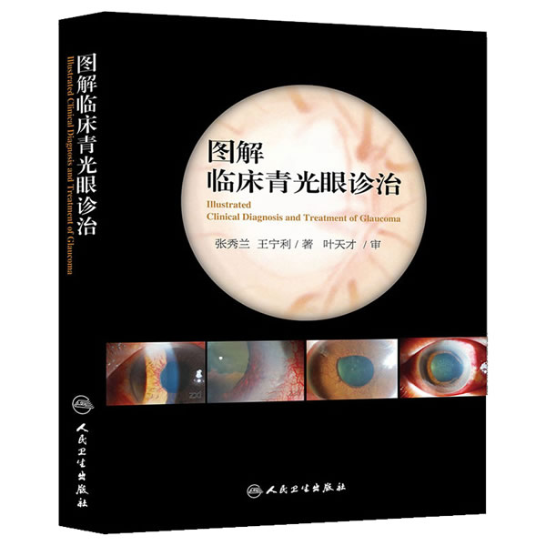 图解临床青光眼诊治【正版图书】