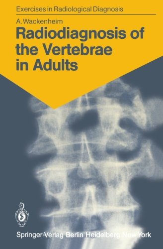 预订 radiodiagnosis of the vertebrae in adults