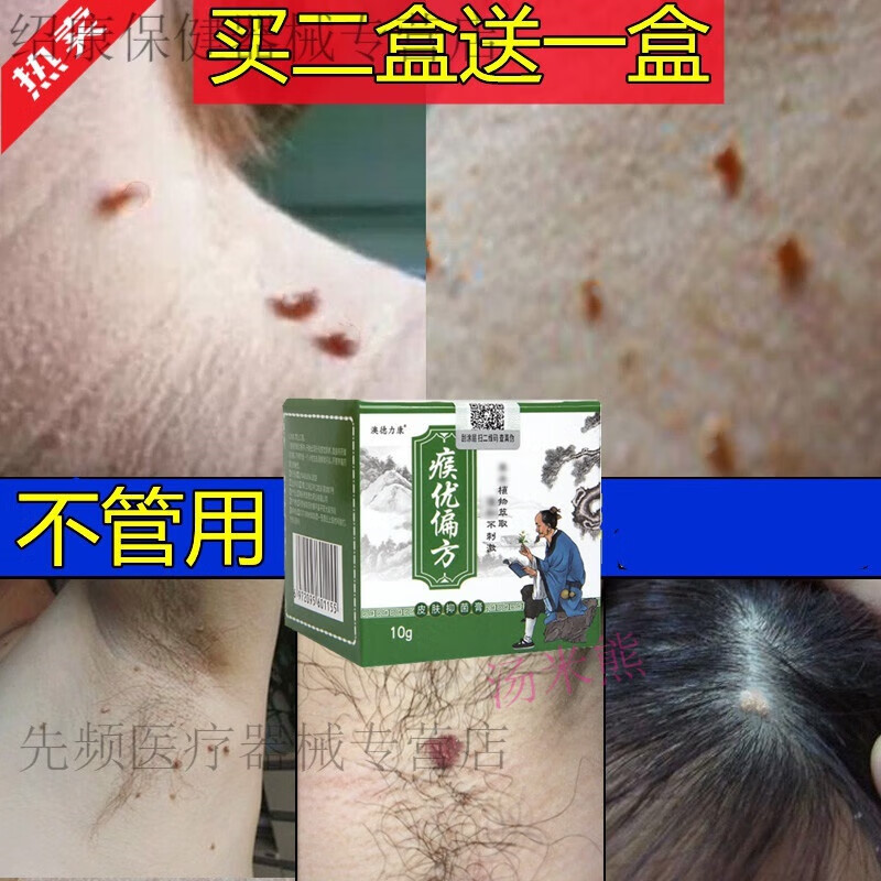 【当天发货】脖子上的丝状疣瘊子痦子神器猴子皮赘药疙瘩辅助型