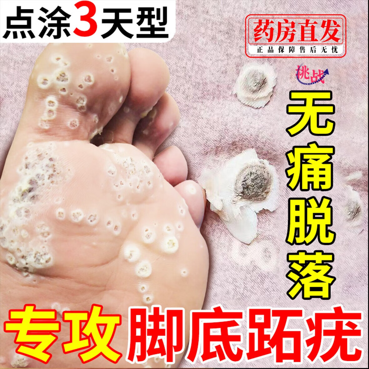 跖疣专i用佣药脚底趾疣去i根专i用去除足部刺猴脚上鸡眼状疣 扁平疣