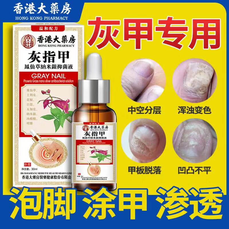 甲院长灰指甲灰指液套装脱甲膏增厚冰醋酸手脚趾灰指甲手脚趾息肉红肿