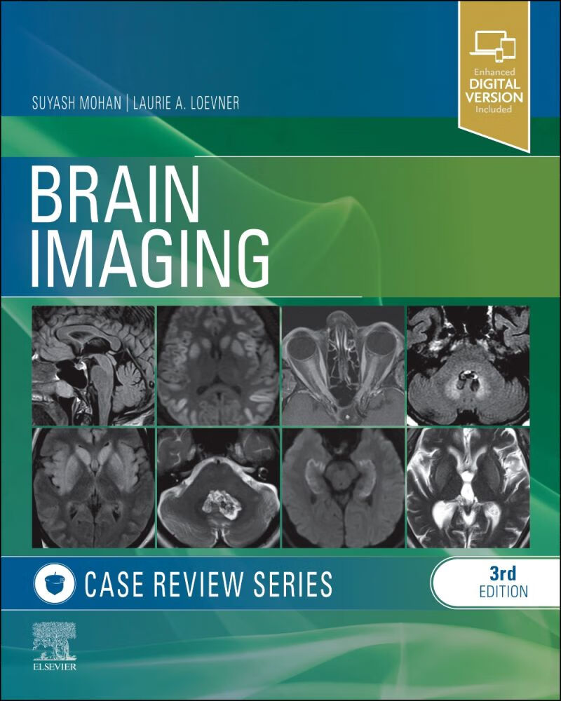 brain imaging: case review series
