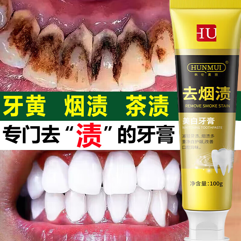 韓倫美羽牙膏口臭黃牙結(jié)石去牙漬煙漬牙膏清新口氣牙齒牙齦護(hù)理 1支裝100g體驗(yàn)裝