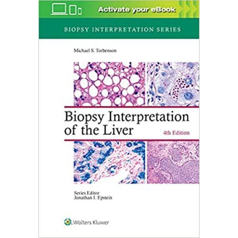 预定biopsy interpretation of the liver (biopsy interpretation