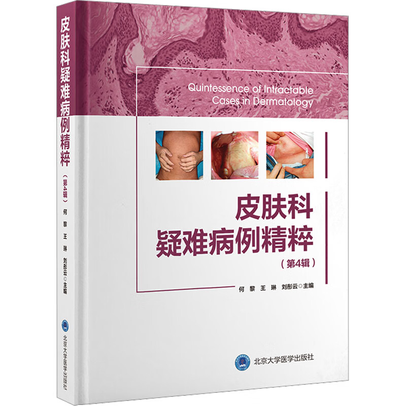 皮肤科疑难病例精粹(第4辑) 图书