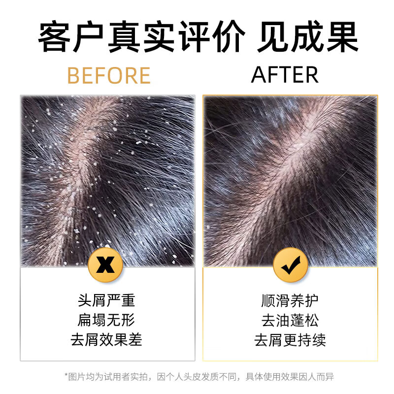 采乐酮康去屑止痒洗发水控油蓬松洗发露清爽 柔顺持久留香洗发乳男女 荐【去屑+控油】到手 1010ml 1瓶