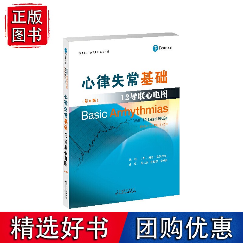 心律失常基础:12导联心电图
