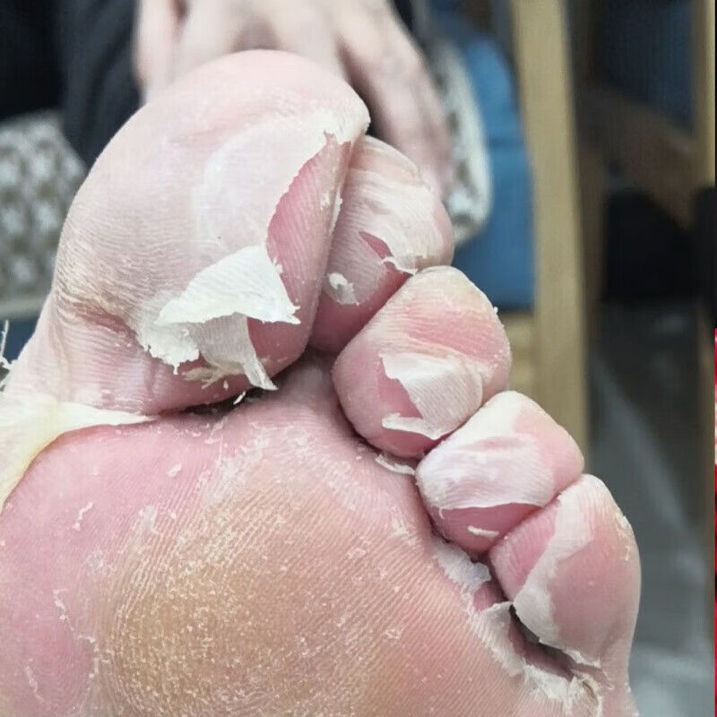 11味泡脚液足浴足疗包脚臭液脚香港护足护脚王脚干裂脚臭气脚痒脚烂