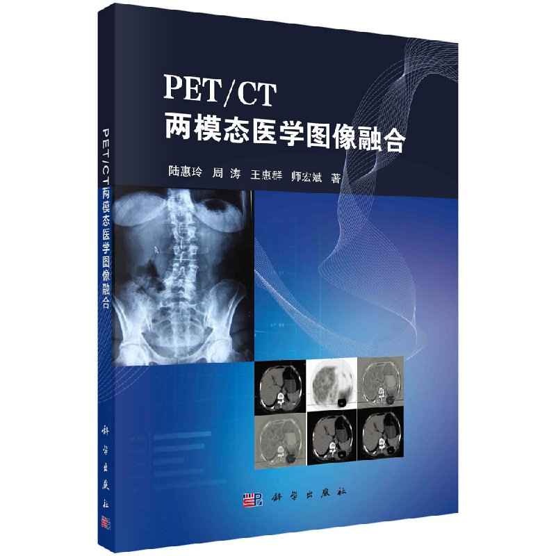 PET/CT两模态医学图像融合