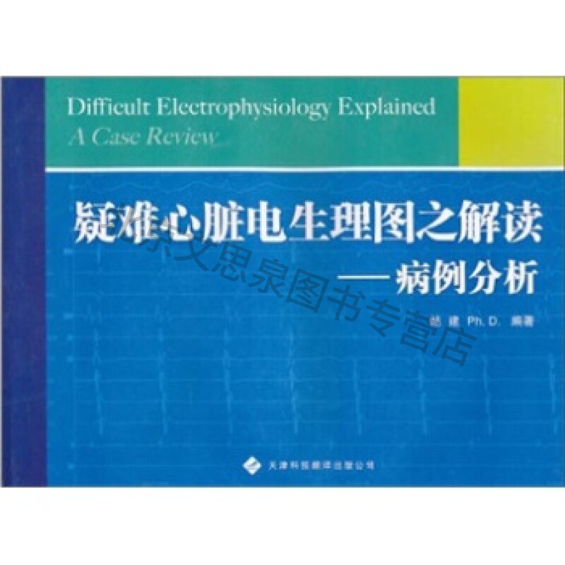 疑难心脏电生理图之解读-病例分析