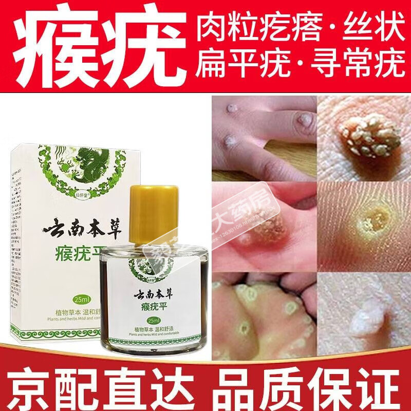 平尤液扁平脸部疣瘊平疣猴子肉粒刺猴脖子颈部 1盒装【初步改善症状】