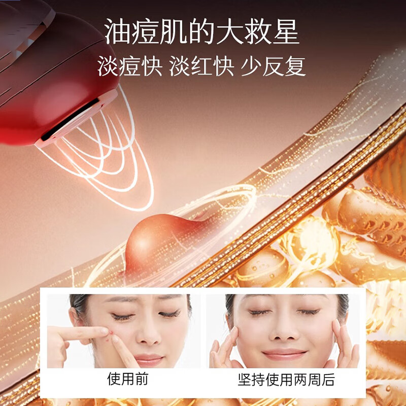 MESMOOTH慕苏美容仪器脸部眼部按摩仪提拉紧致家用清洁去黑头导出导入仪光子嫩肤生日礼物送女友 星钻红Pro