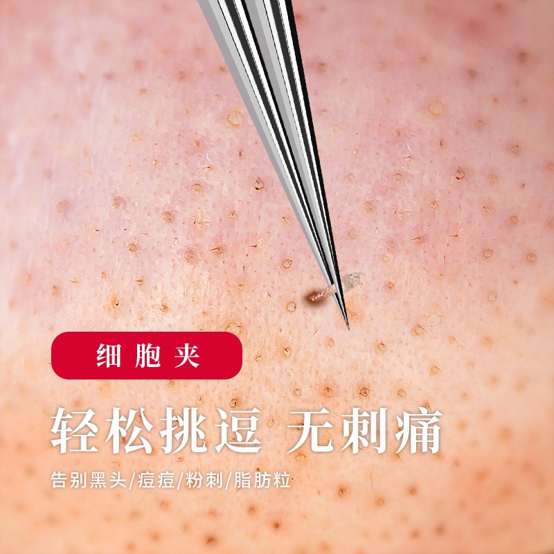 DITI【超尖细粉刺夹】细胞夹粉刺针刮黑头夹镊子暗疮针专用挑痘工具