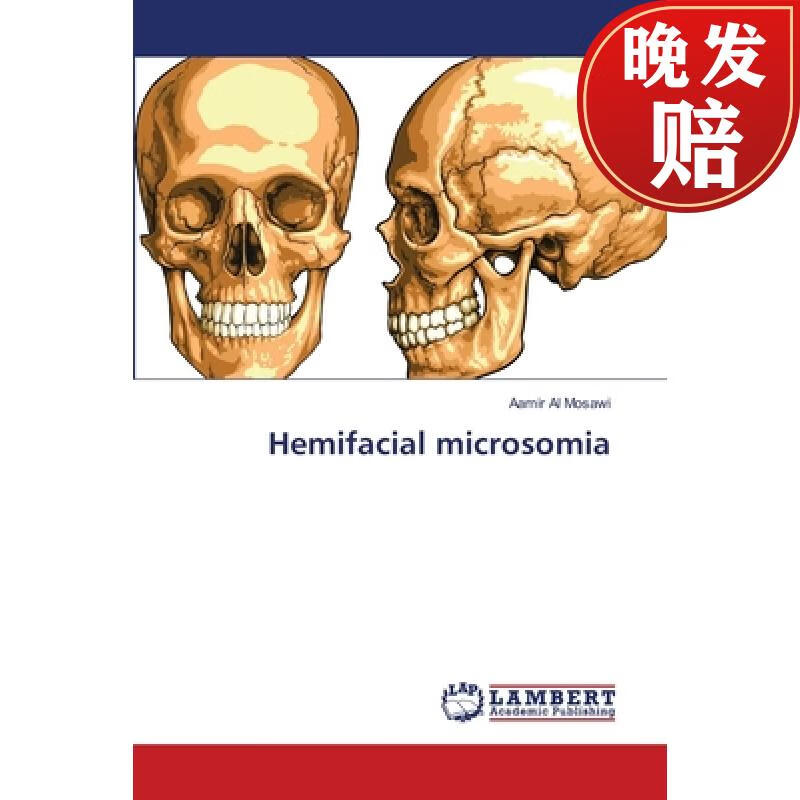 【4周达】hemifacial microsomia