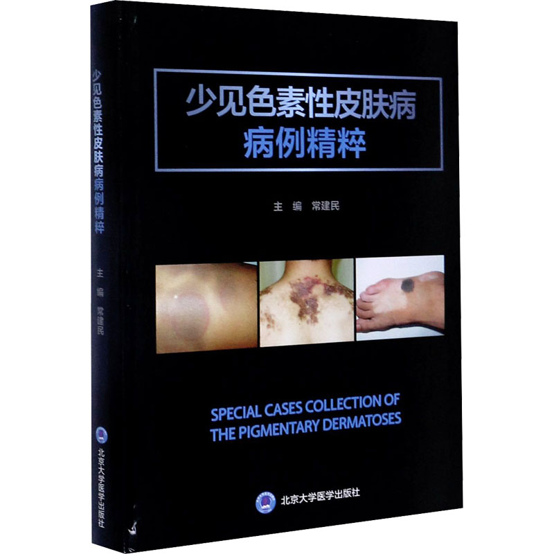 少见色素性皮肤病病例精粹 常建民 编 书籍