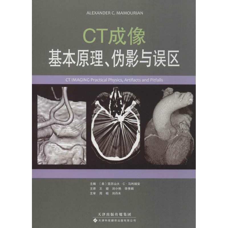 CT成像