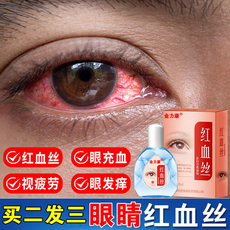 眼药水红血丝眼药水眼睛眼红 眼血丝去i红血丝结膜充血视力模糊眼部酸