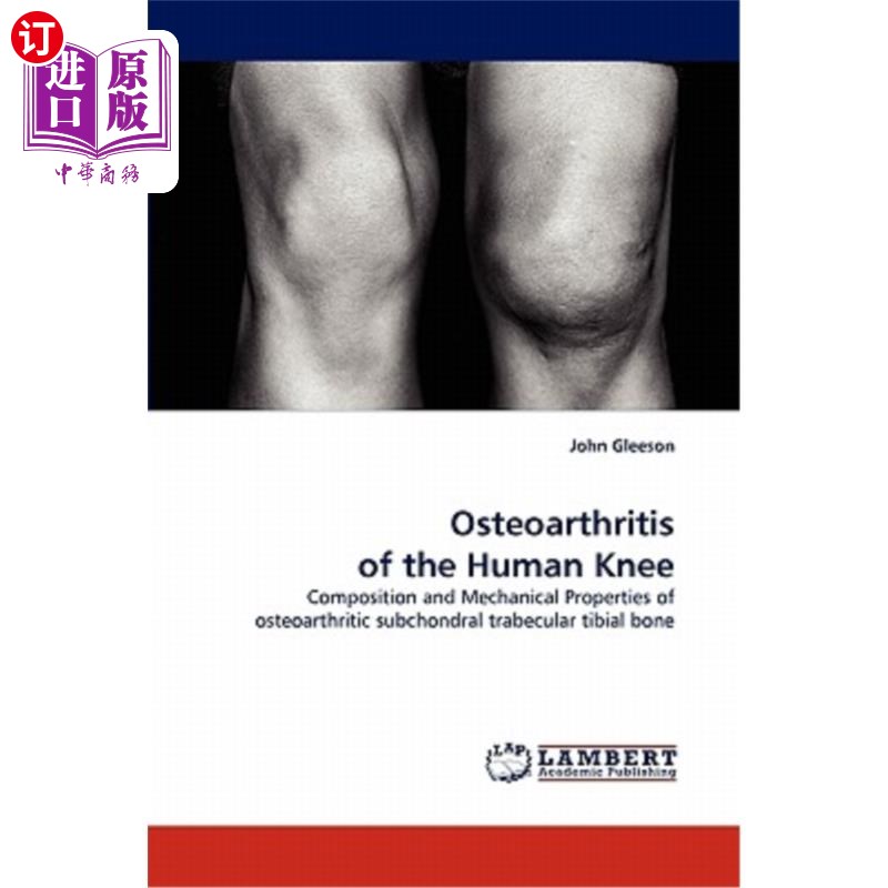 海外直订osteoarthritis of the human knee 人膝骨关节炎