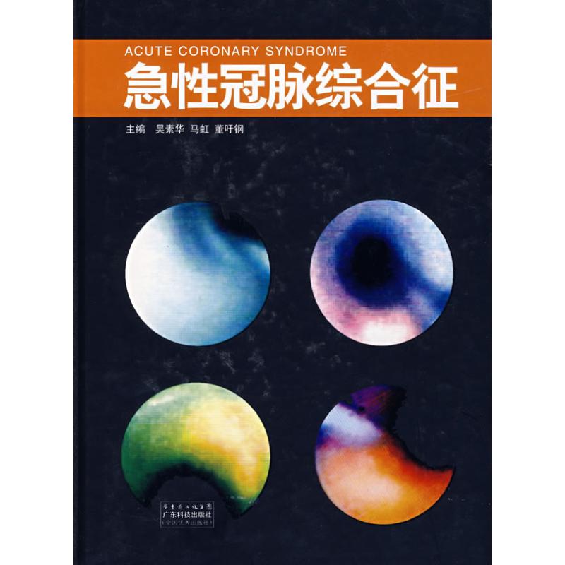 急性冠脉综合征