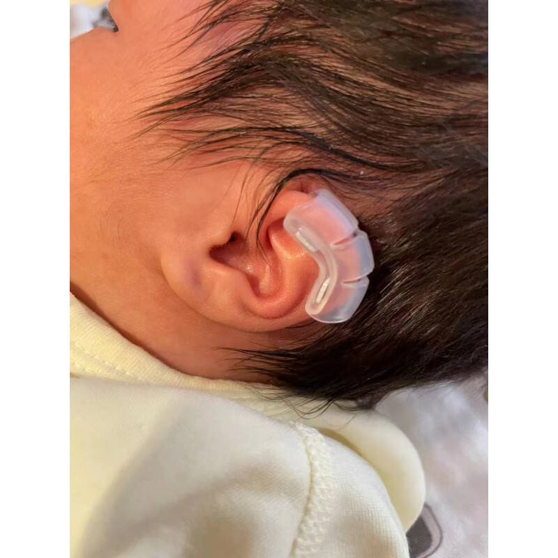 婴儿器贴面耳贴面耳撑招风耳神器精灵耳新生的儿耳朵器 耳夹(一个) l