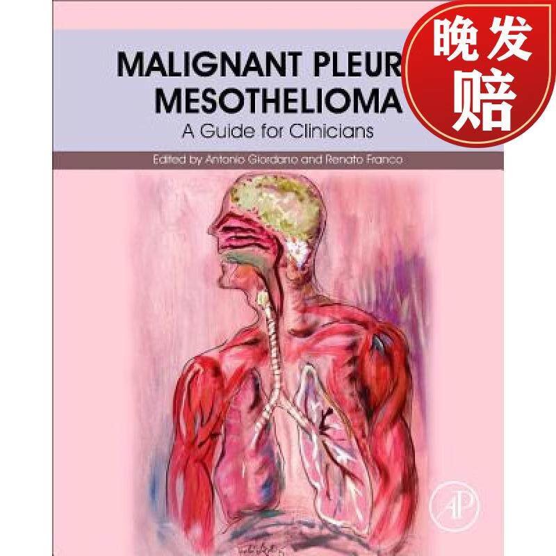 【4周达】malignant pleural mesothelioma : a guide for clinicians