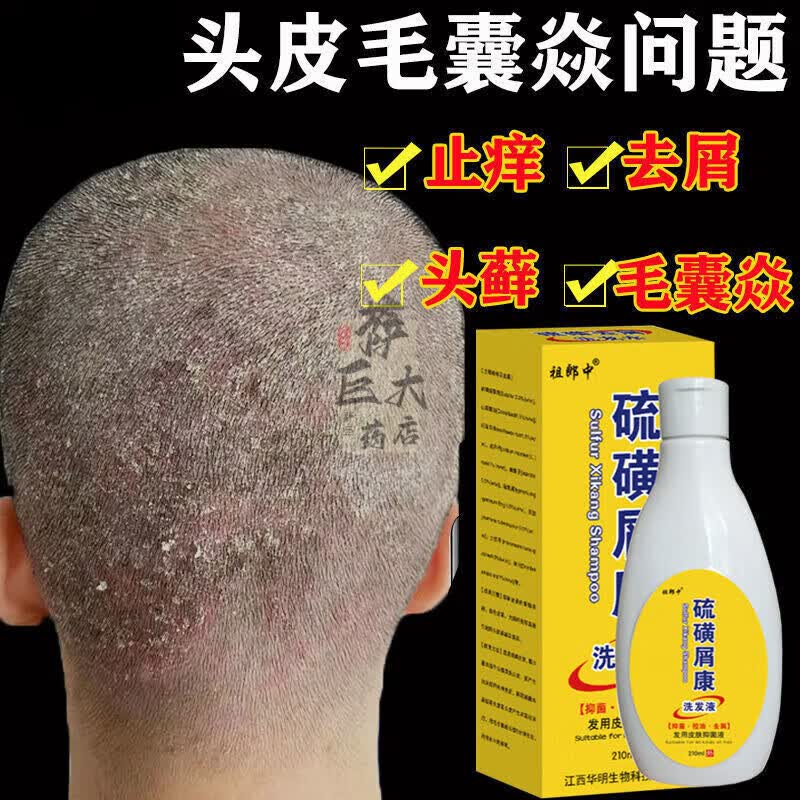 硫磺洗头膏上海洗发水膏毛囊有炎脂溢性头皮屑头虫头虱硫磺皂控油头皮