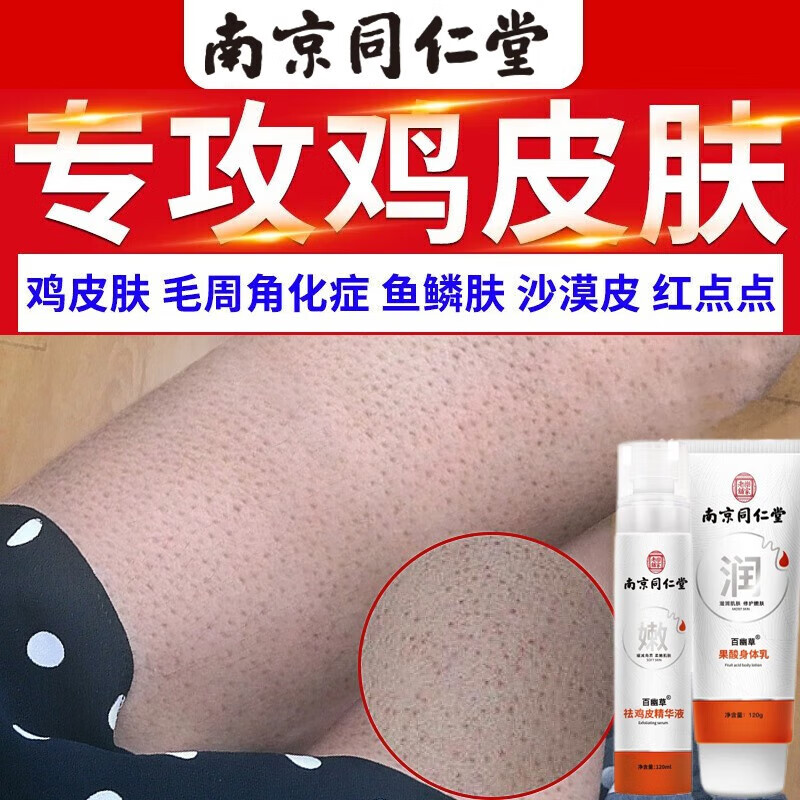 南京去鸡皮肤鱼鳞病身体乳精华液套装毛周角化毛囊蛇皮肤去 一盒装