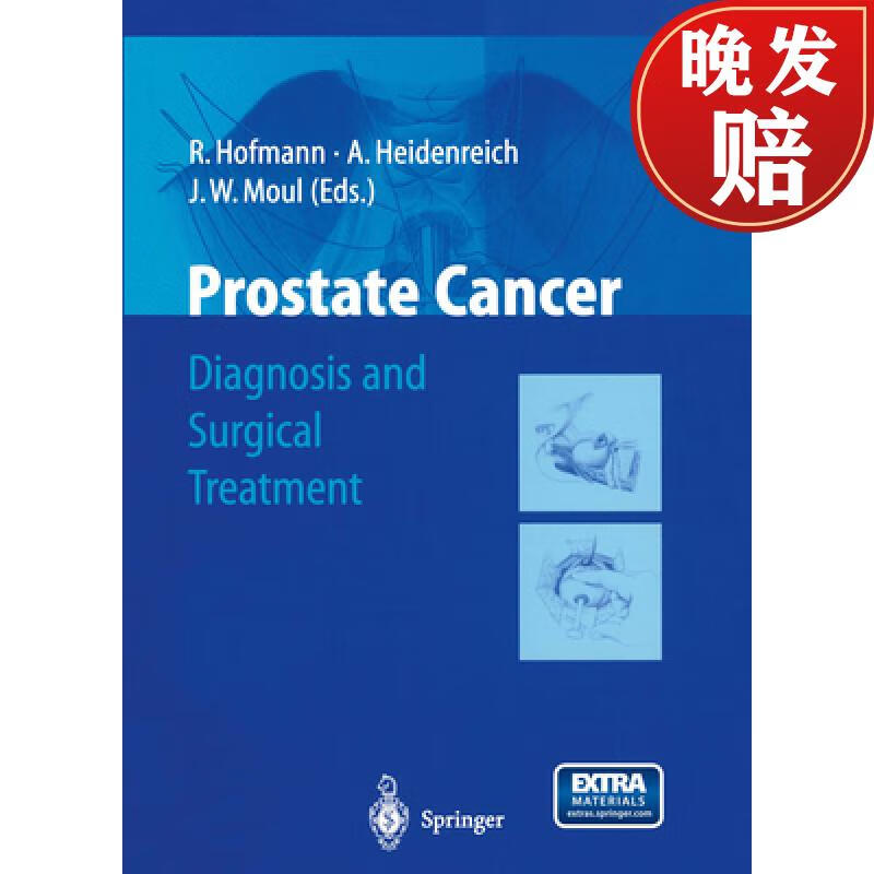 【4周达】prostate cancer: diagnosis and surgical treatment