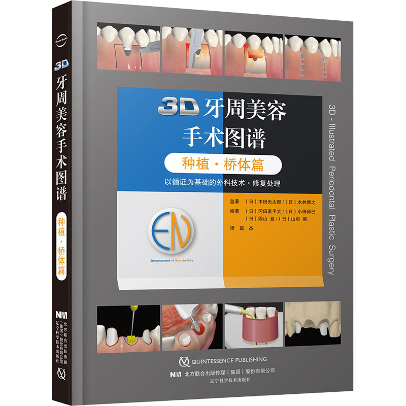 3D牙周美容手术图谱 种植·桥体篇