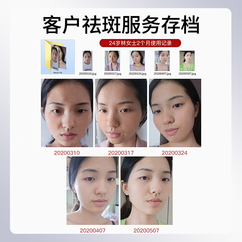 百灵鸟烟酰胺原液美白精华美白淡斑去斑淡化黑色素维生素b3烟酰胺男女士