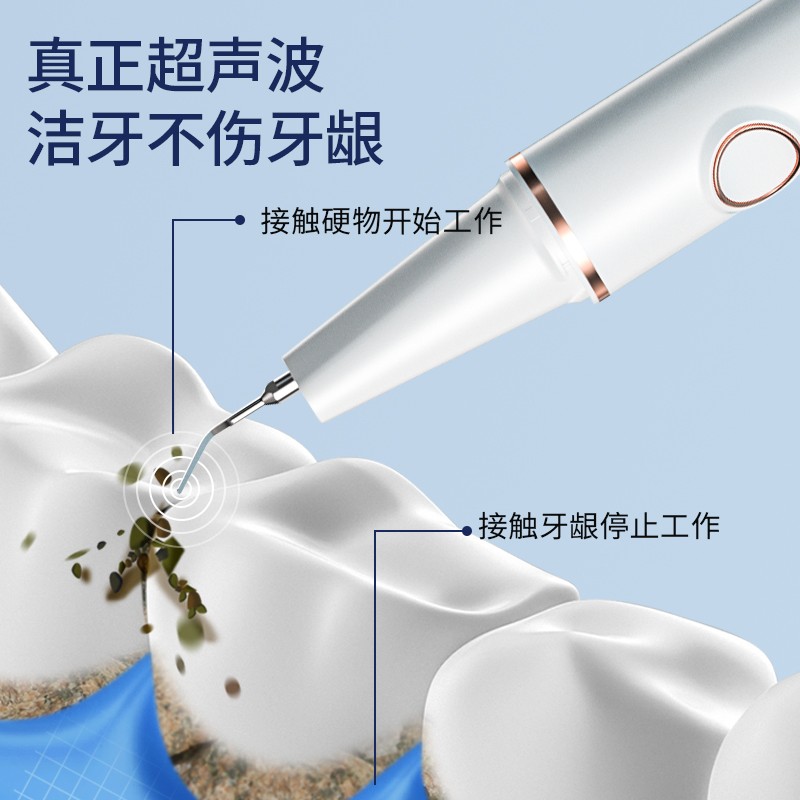 HYUNDAI韩国现代 可视超声波洁牙器洗牙结石去除器牙齿牙垢清洁洗机去除牙结石仪器 超声波可视洁牙器【320w/min高频声波震动款】