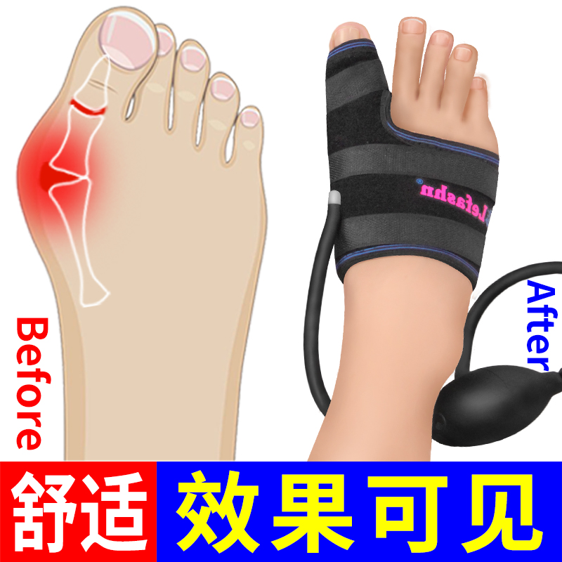 风靡全球的智能手环价格走势分析