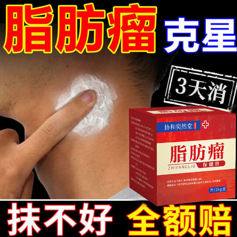 脂肪瘤消l肿膏【99%当晚修复】消36种皮下凸起肿块硬块脂肪瘤克星 买