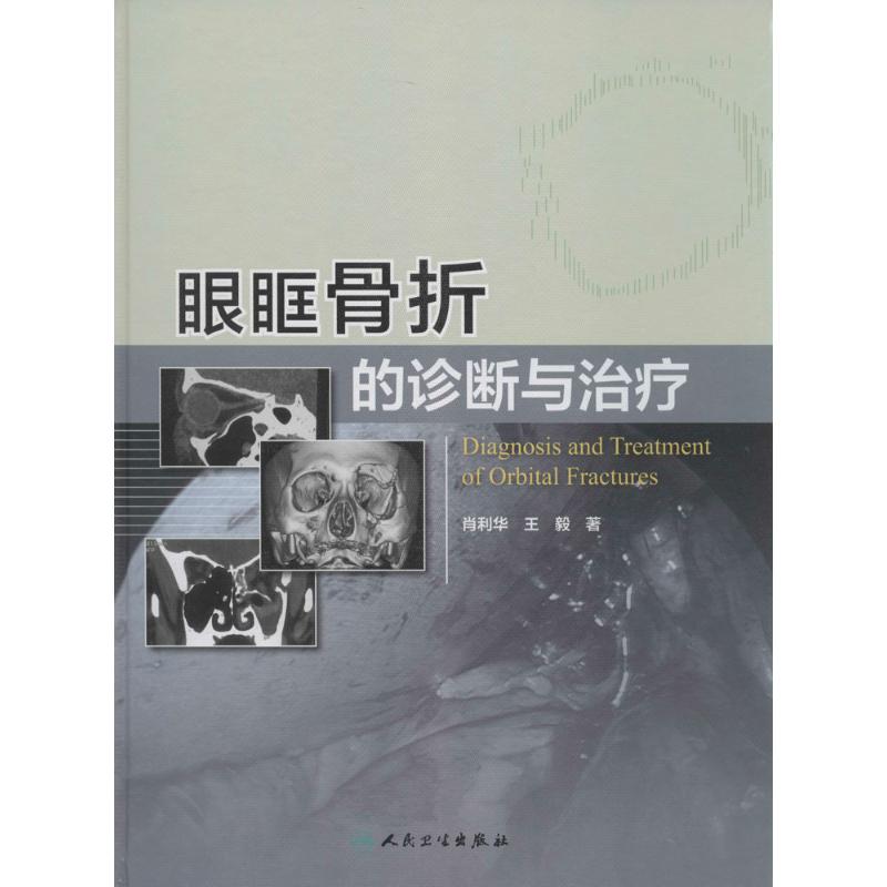 眼眶骨折的诊断与治疗
