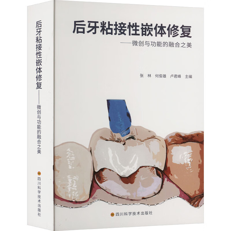 后牙粘接性嵌体修复——微创与功能的融合之