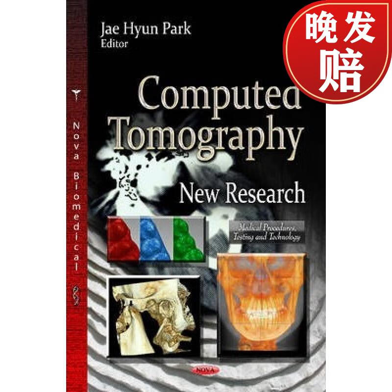 【4周达】computed tomography: new research