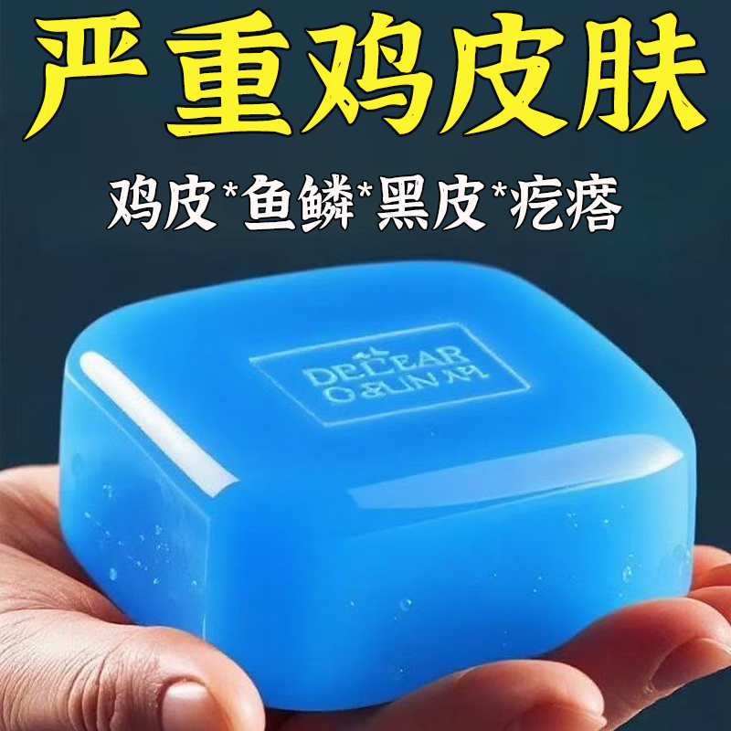 国药匠心【维A酸鸡皮皂】鸡皮鱼鳞疙瘩毛囊角化皮肤保湿手工皂 缓解中度鸡皮.【实发五盒】
