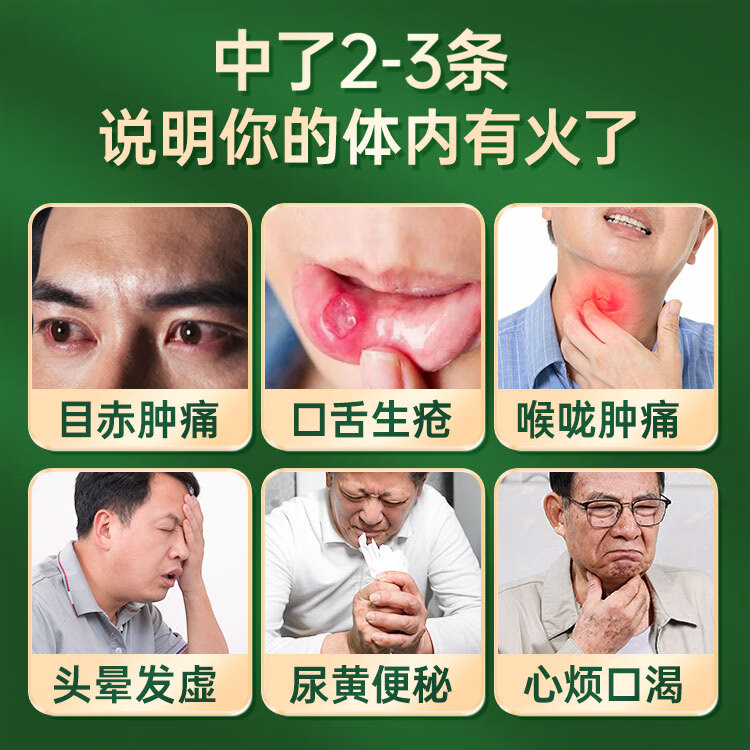 [金辉] 比拜克胶囊 0.36g*18粒/盒清热解毒通便头疼目赤牙龈肿痛官店方大旗舰京自東药營房 2盒 老包装