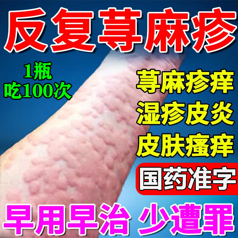 荨麻疹专用药 慢性荨麻疹过敏止痒增强免疫力风团红斑丘疹皮肤瘙痒